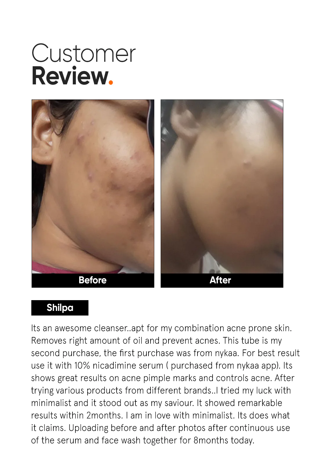 Salicylic Acid + LHA 2% Cleanser - Image 5